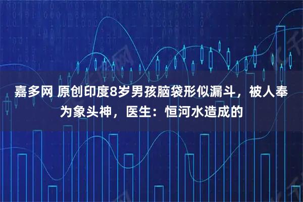 嘉多网 原创印度8岁男孩脑袋形似漏斗，被人奉为象头神，医生：恒河水造成的